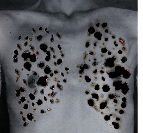 Wenn das Versagen der Gesundheitsbürokratie krank macht